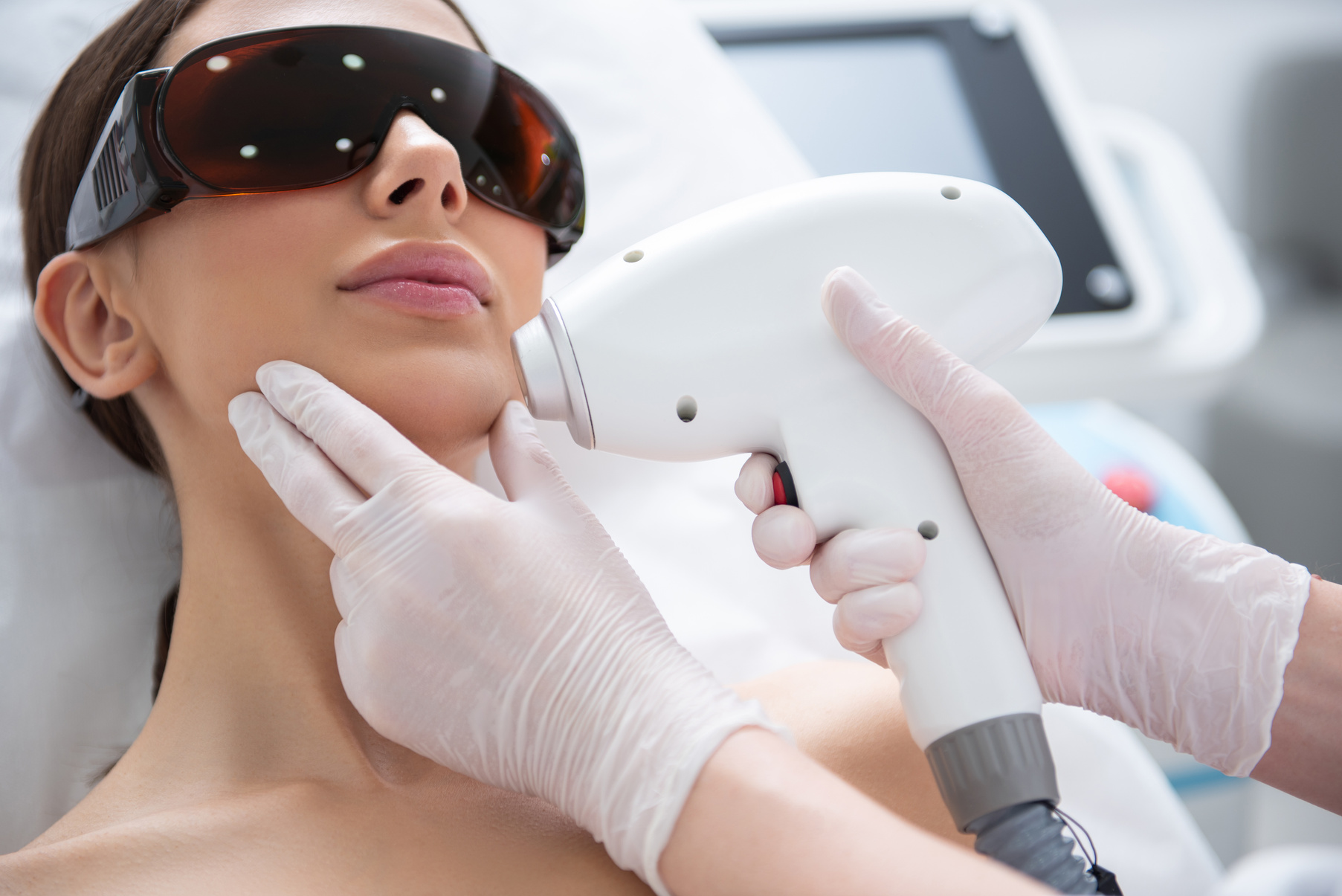 Young lady on chin laser hair removal procedure